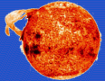 image of sun